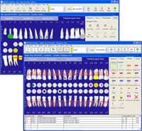 Charting Software System | Orthodontic Products