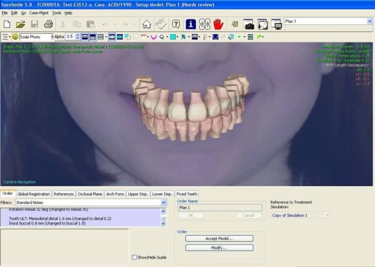 OraMetrix Launches SureSmile 5.8 Orthodontic Products