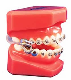 Columbia PA Orthodontist, Elastics For Braces