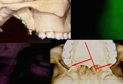 Mayes Fig 3 opt