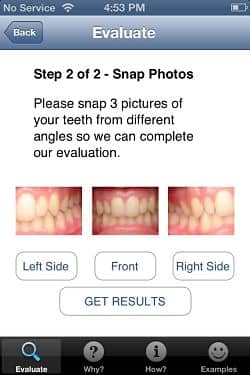 GreatSmiles AlignerMeter opt