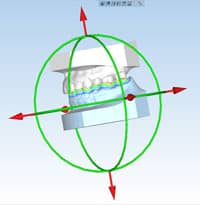 Image of 3D dental scan.