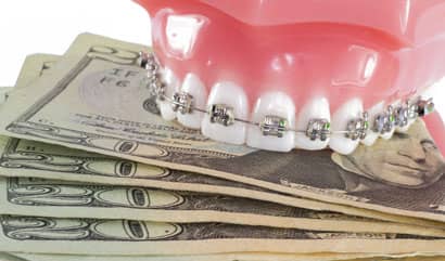 ADA: Dental Spending Remained Flat Through 2012