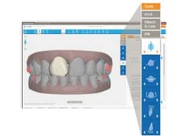 OP AlignTechnology ClinCheckPro SIZED250