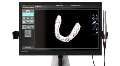 3M Digital Oral Care Unveils New 3M True Definition Scanner