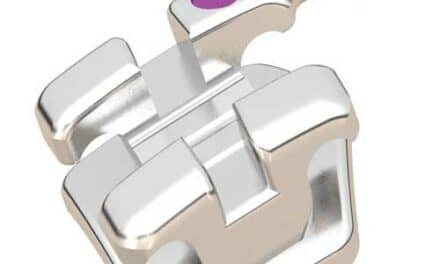 Action Orthodontics Introduces Mini Embrace Bracket System