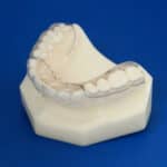 Great Lakes Orthodontics Introduces Hybretain Retainer