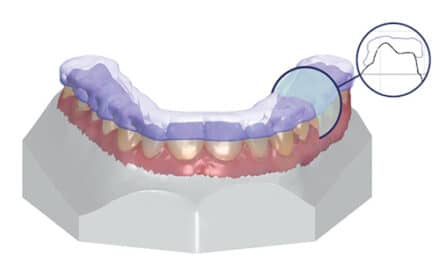 3Shape Ortho System Receives FDA 510(k) Market Clearance