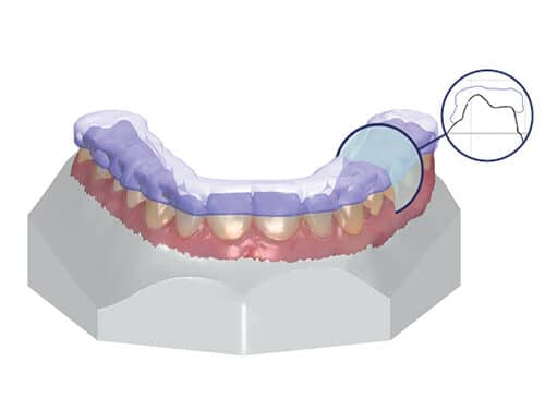 3Shape Ortho System Receives FDA 510(k) Market Clearance