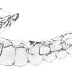 Industry Insider: The Aligner Expansion