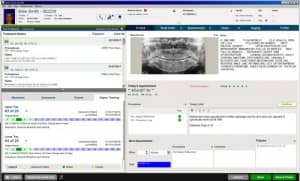 Carestream_OrthoTrac14_TX-Card-AlignerTracking