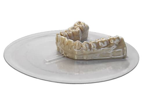 3d Printing And In House Aligners Orthodontic Products