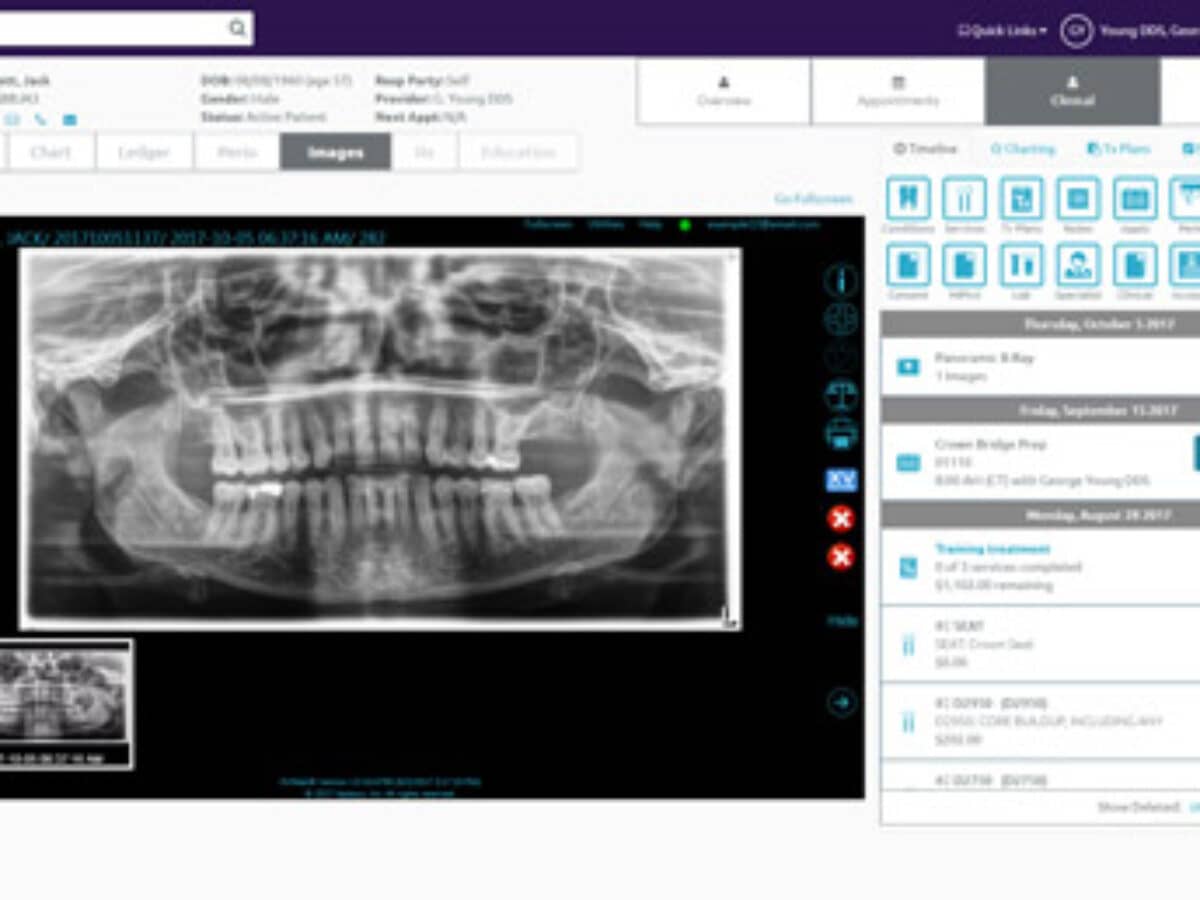 Patterson Dental Debuts Fuse Practice Management Software