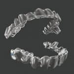 Invisalign Cleared for Treatment with Mandibular Advancement