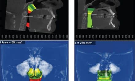 “Airway” Knowledge Has Changed My Diagnosis and Treatment Planning