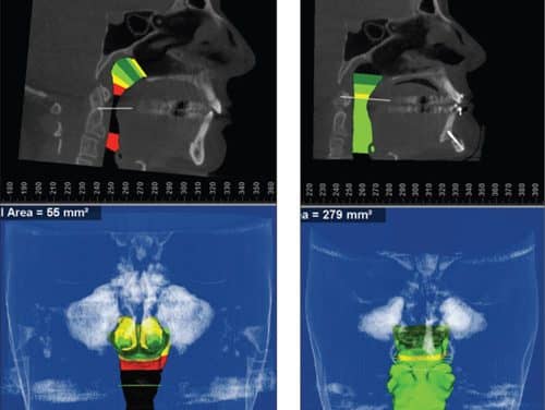 “Airway” Knowledge Has Changed My Diagnosis and Treatment Planning