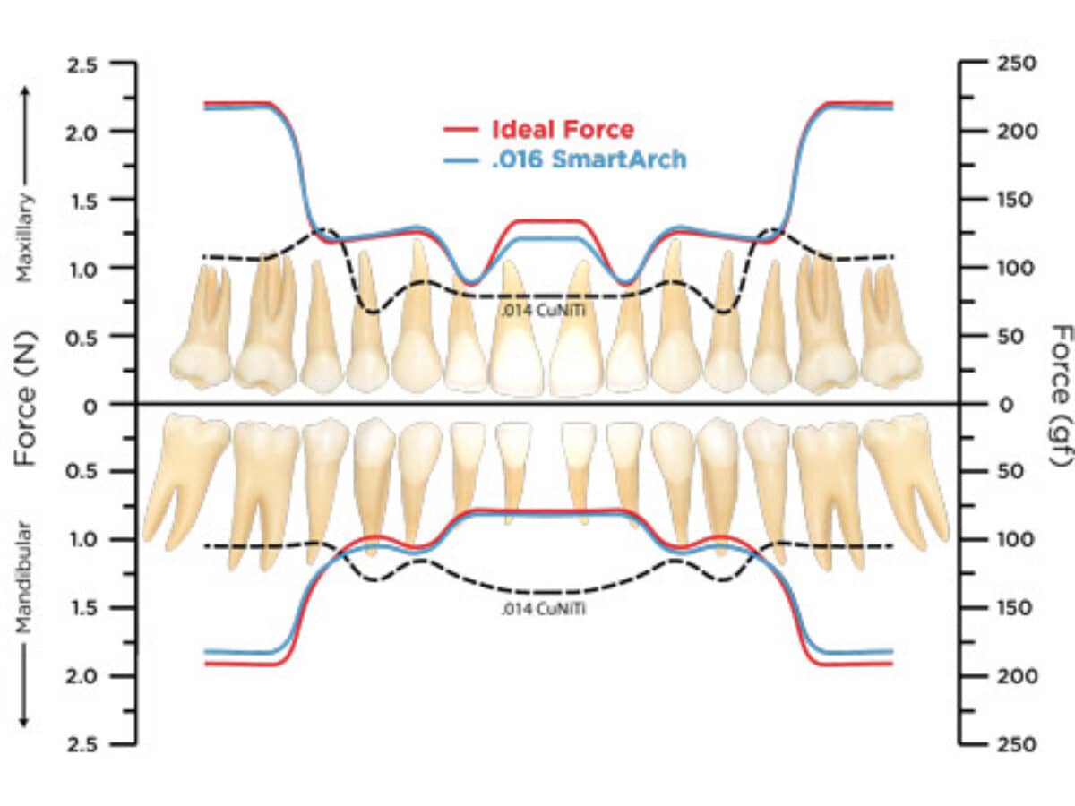 No Tooth Left Behind | Orthodontic Products