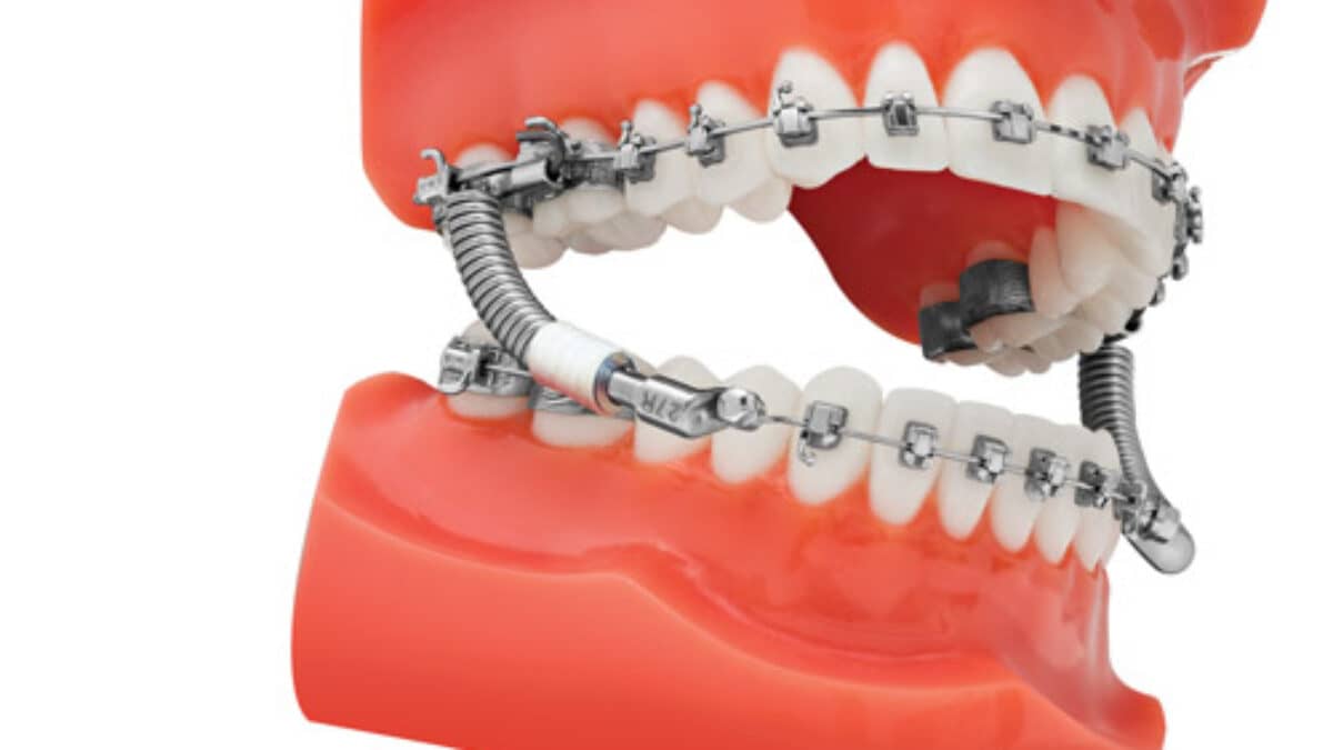 TP-Orthodontics-Jasper-Vektor-