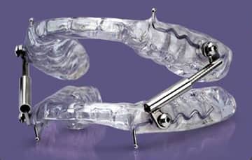 Glidewell Dental Introduces New Mandibular Advancement Device