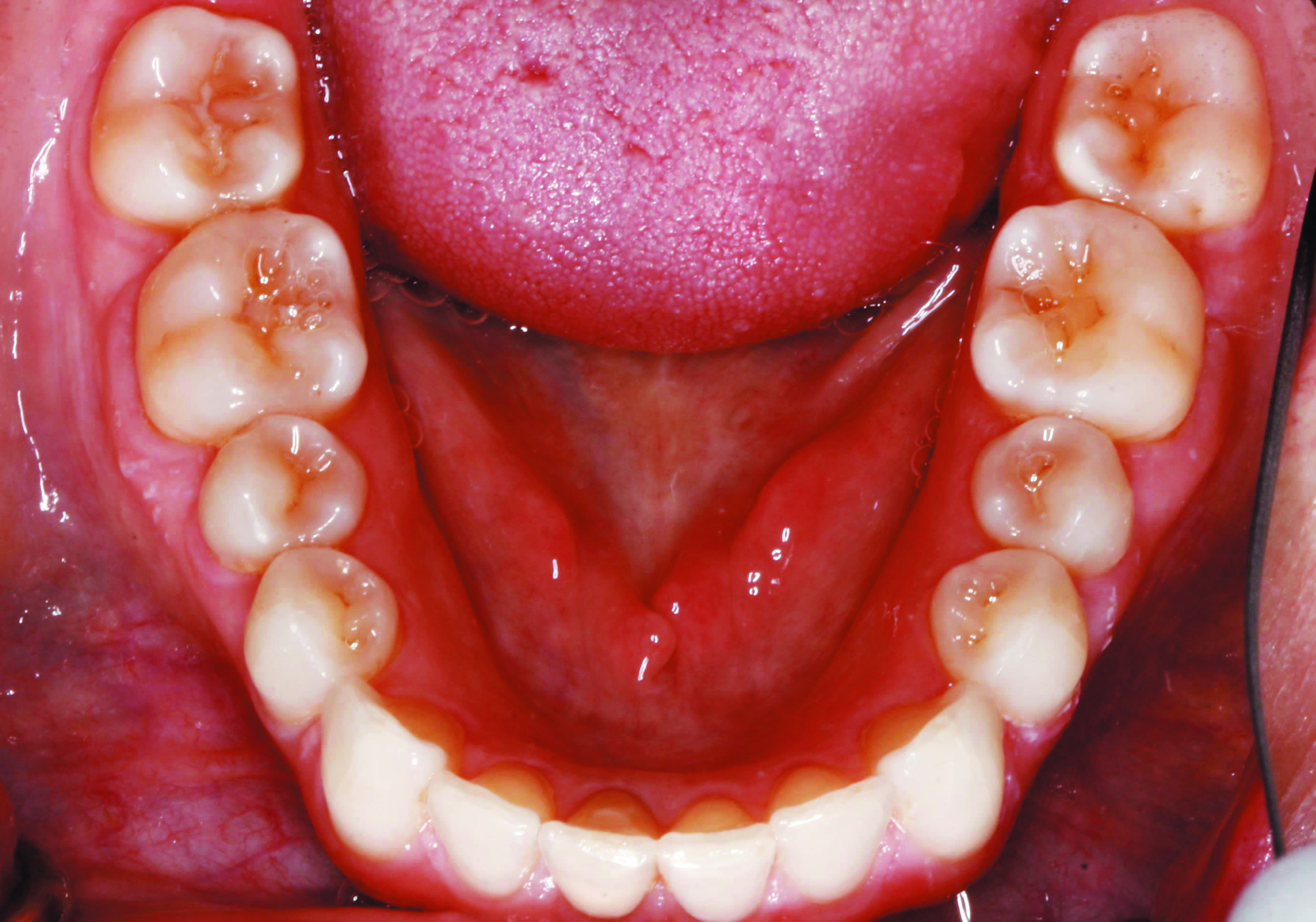 Finding the Right Aligner Brand for Your Practice Orthodontic Products