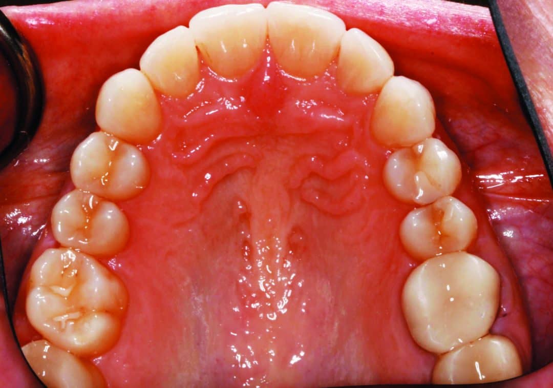 Finding the Right Aligner Brand for Your Practice Orthodontic Products