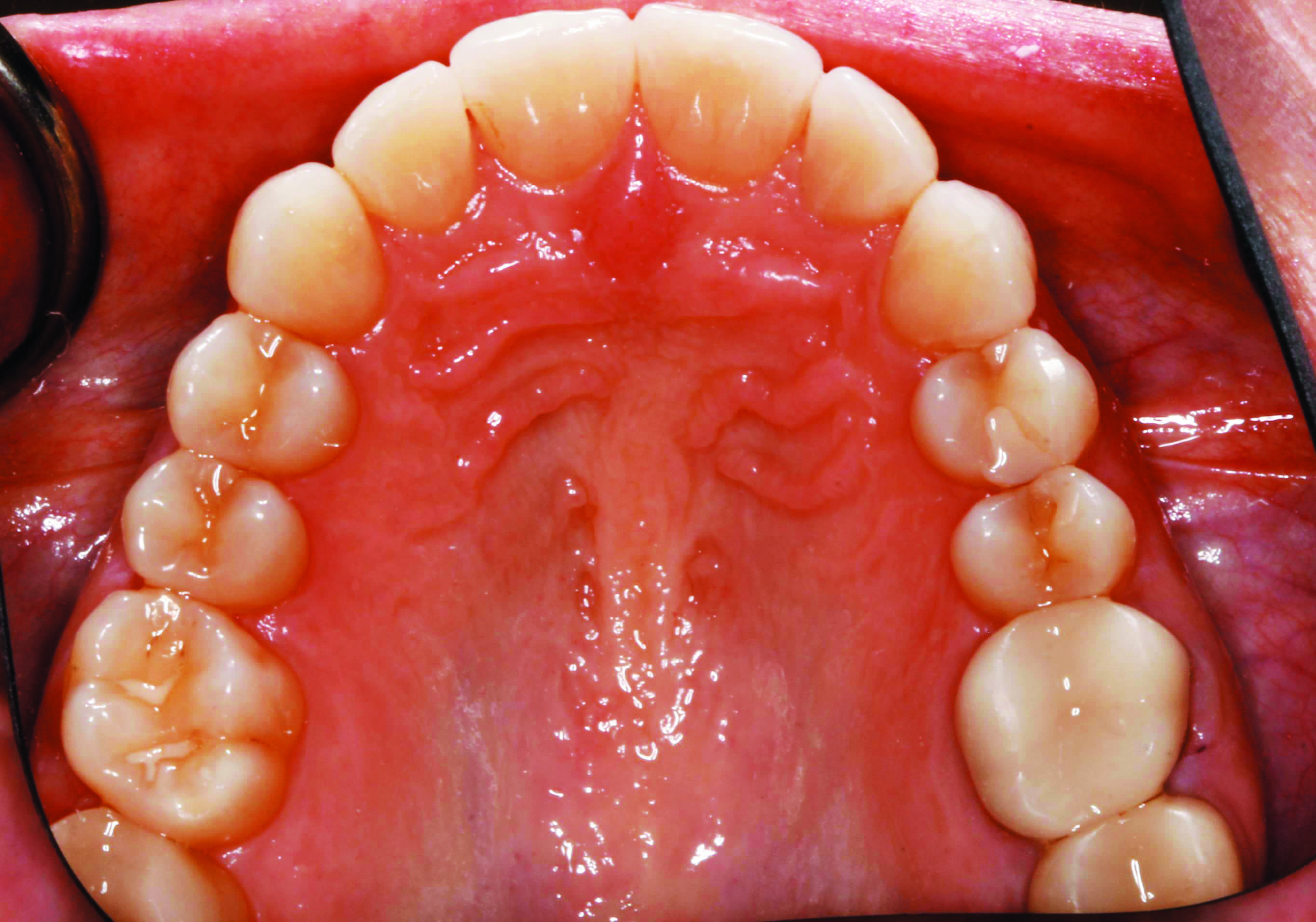 Finding the Right Aligner Brand for Your Practice Orthodontic Products