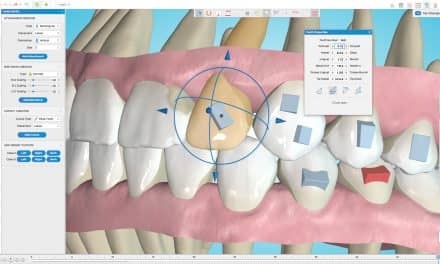 Ormco Upgrades Spark Clear Aligner Approver Software and Portal