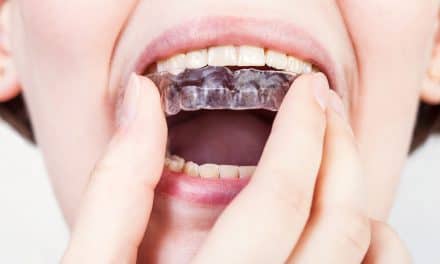 Consumer Research Study Finds Clear Aligner Patients Underserved by Dental Wax