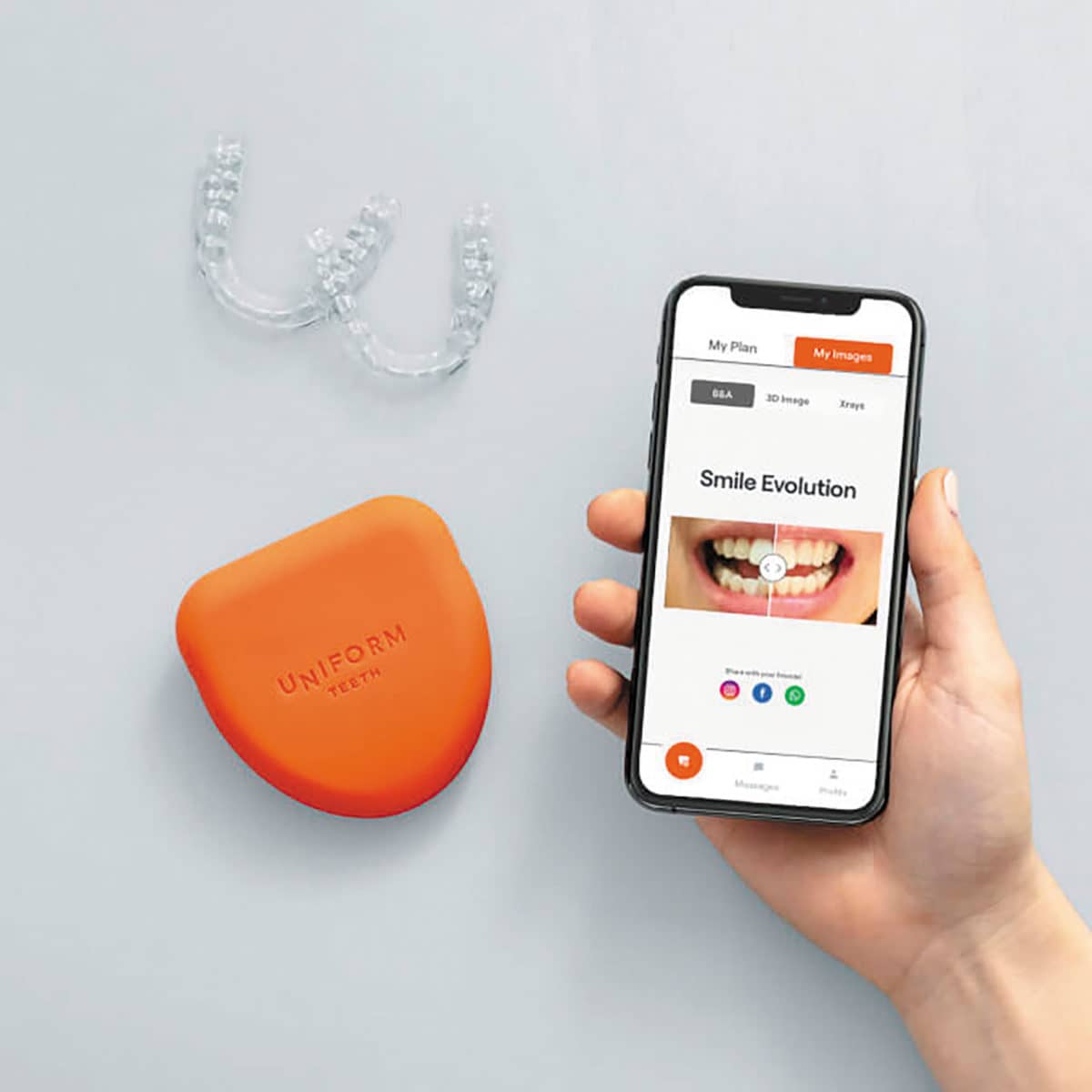 How Uniform Teeth’s Aligner Approach Keeps Doctors in the Loop