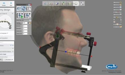 Whip Mix Now Offers Bellus3D Dental Pro Scanning