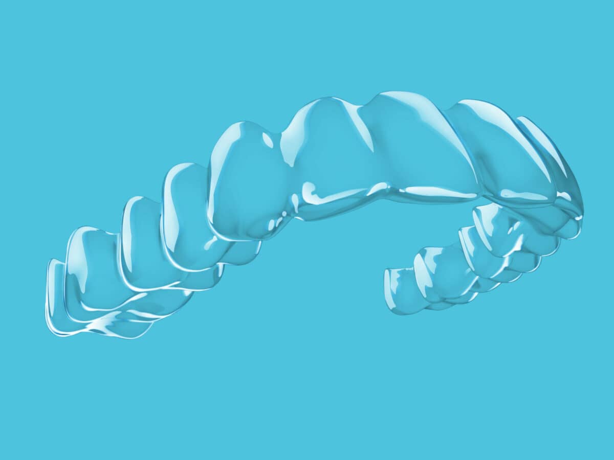 Ormco Spark Aligners Receive FDA Clearance for Mixed Dentition