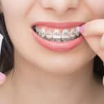 OrVance and Coalition of Orthodontists and Dentists Sends Letter to FDA, FTC Raising Concern Over Misbranded Dental Wax