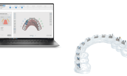 New DIBS AI Software from OrthoSelect Aims to Enhance Patient Case Setups, and Improve Overall Treatment