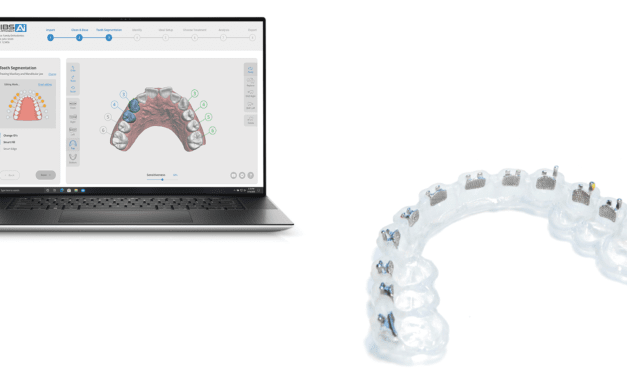 OrthoSelect Makes DIBS AI Compatible with Braces On Demand