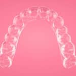 ClearCorrect Launches ClearPilot Digital Treatment Design Tool