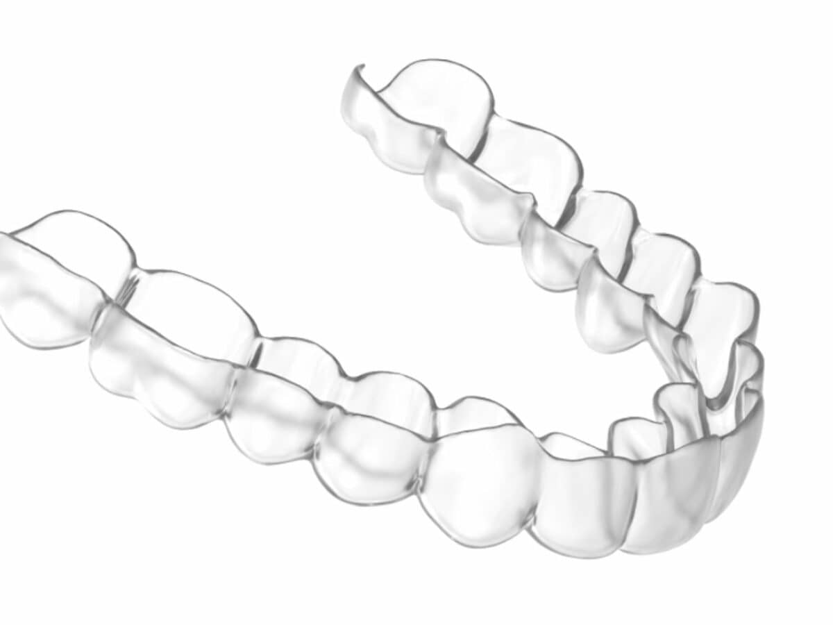 健康・医学 Aligner generation 健康・医学 Aligner generation Full article: Clear aligners