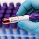 Report Finds COVID-19 Rate Among Dental Professionals is Less Than 1%