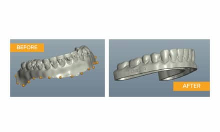 Webinar: How to Use EasyRx Software to Prepare Your Models and 3D Print In-House