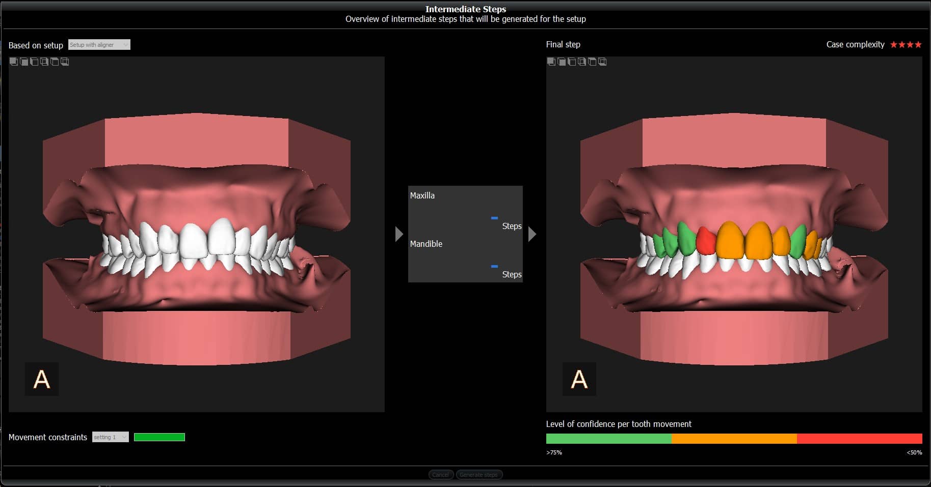 Carestream Dental Launches CS Model+ 5 for InHouse Aligners