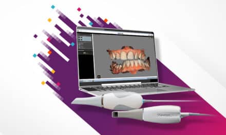 Carestream Dental Will Sell its Scanning Technology Business