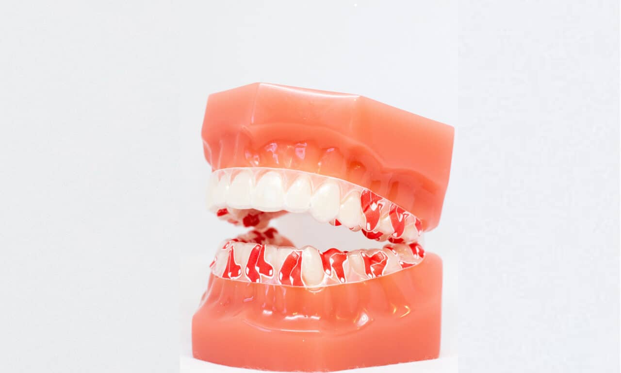 OrVance launches temporary tooth repair product