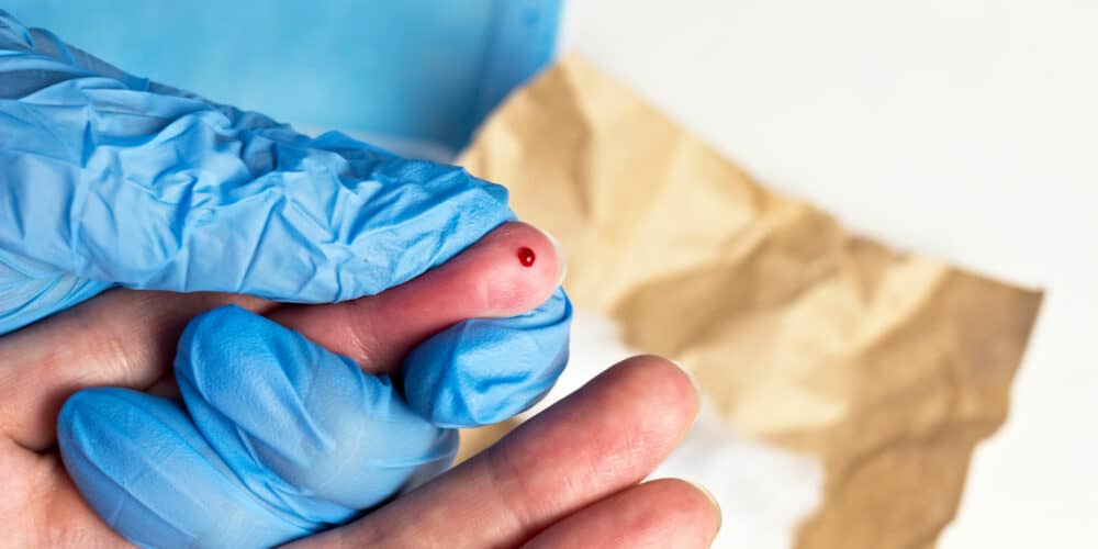 Dealing with PTSD After Needlestick Injuries Orthodontic Products