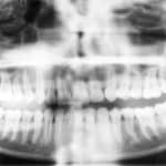 Henry Schein One Launches Dentrix Imaging Center