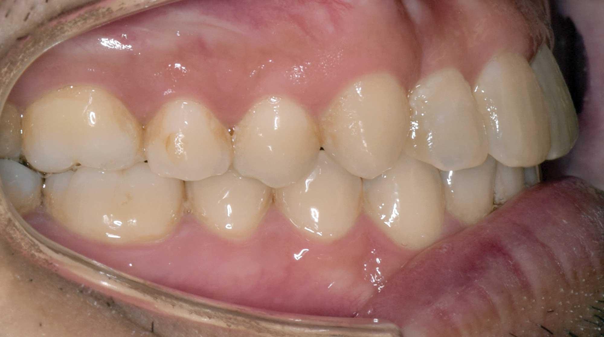 Dr John on Teaching Orthodontic Treatment Mechanics Online