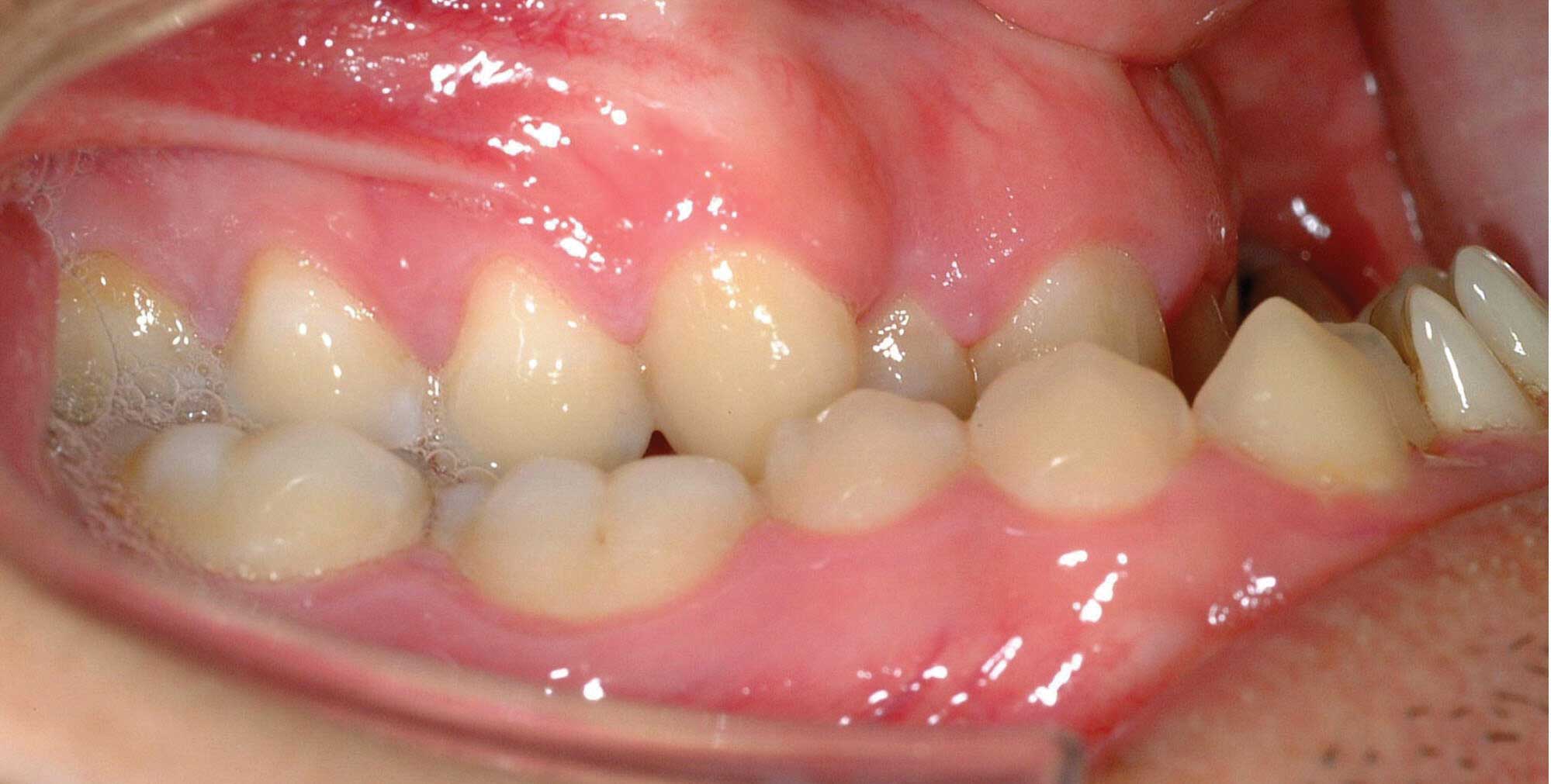 Dr John on Teaching Orthodontic Treatment Mechanics Online