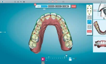 Clinical Products Spotlight: New Tools Make Complex Cases Even Easier