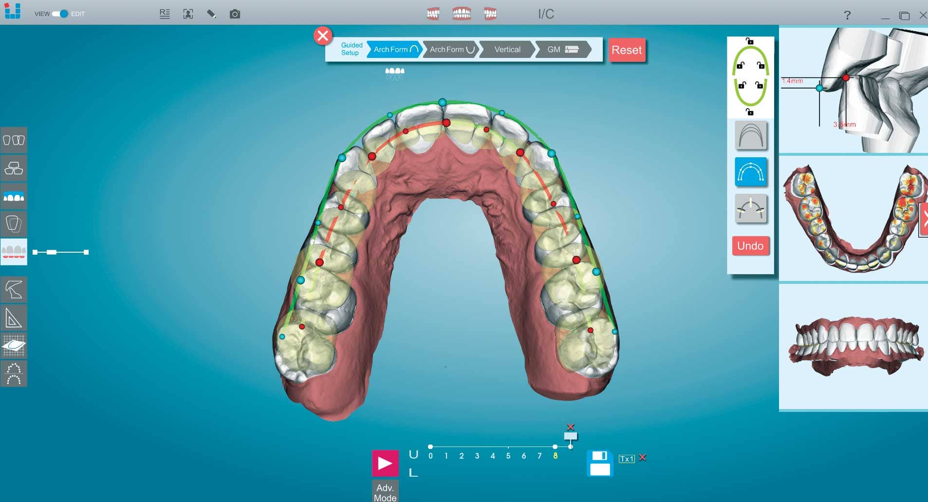 Clinical Products Spotlight: New Tools Make Complex Cases Even Easier ...