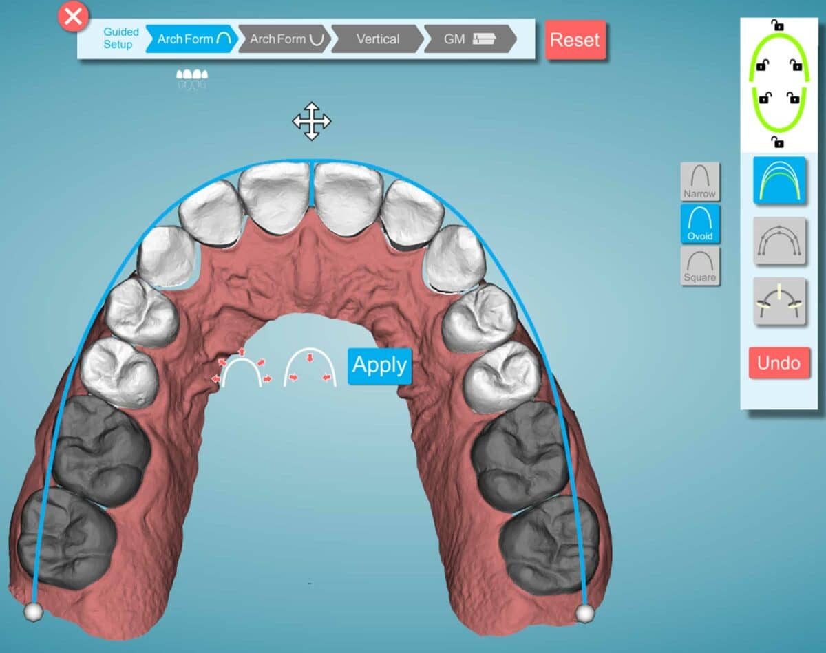 Clinical Products Spotlight: New Tools Make Complex Cases Even Easier ...