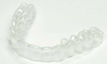 uLab Webinar Offers Tips on Combining Aligners With Treatment