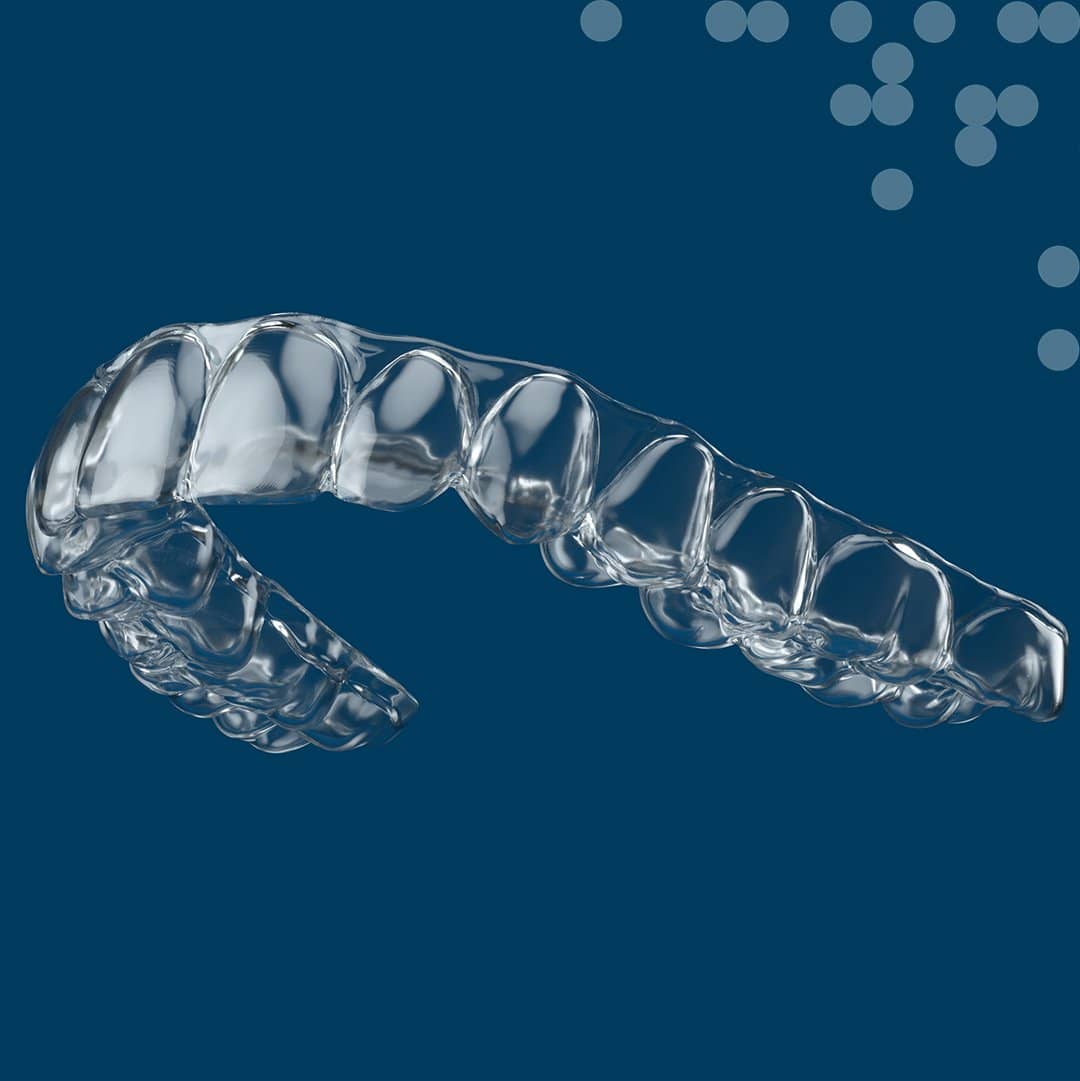 Pressing the Boundaries of Aligners Expectations Orthodontic Products